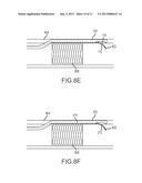 Reentry Catheter and Method Thereof diagram and image