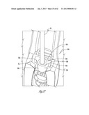 FLOW STOP PROTECTIVE MEANS FOR A FLUID DELIVERY DEVICE OF A MEDICAL PUMP diagram and image