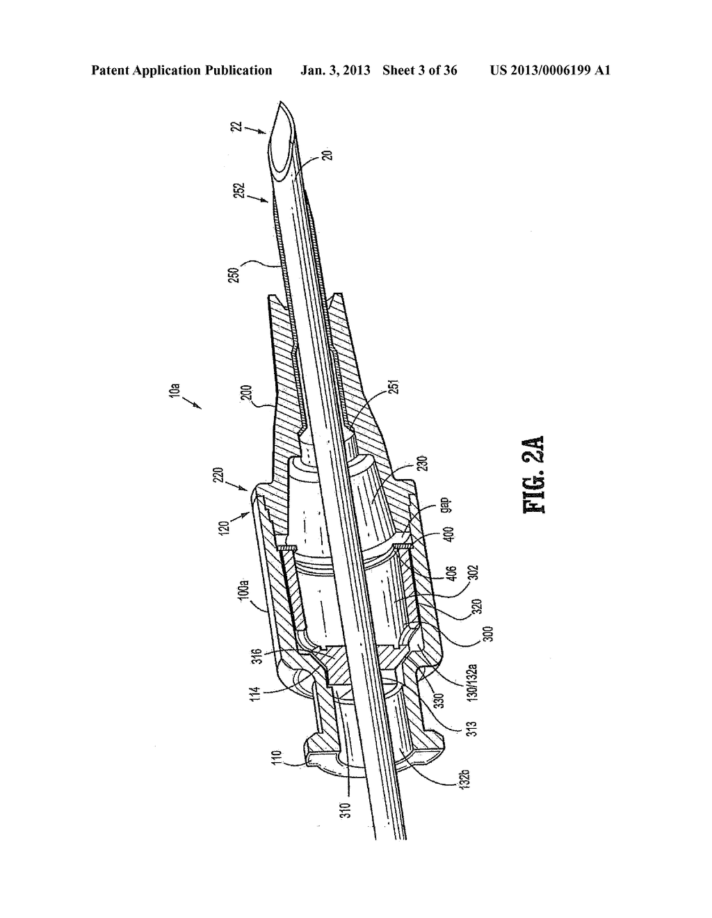 IV Catheter with In-Line Valve and Methods Related Thereto - diagram, schematic, and image 04