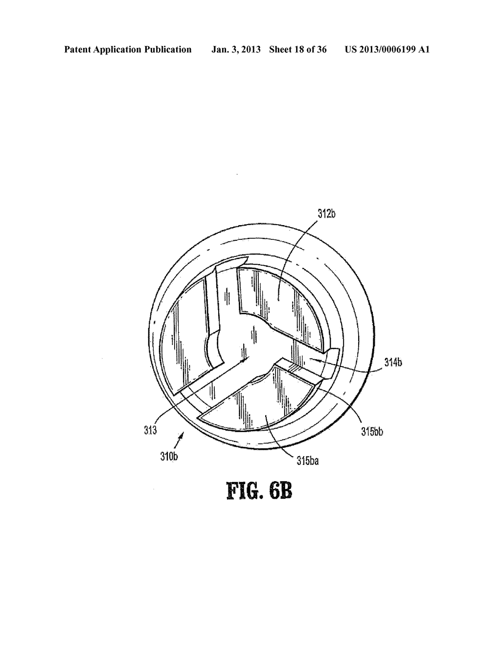 IV Catheter with In-Line Valve and Methods Related Thereto - diagram, schematic, and image 19