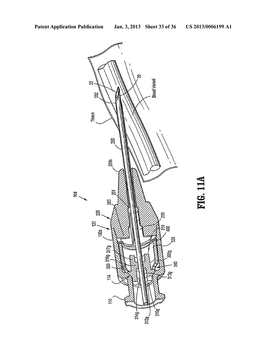 IV Catheter with In-Line Valve and Methods Related Thereto - diagram, schematic, and image 34