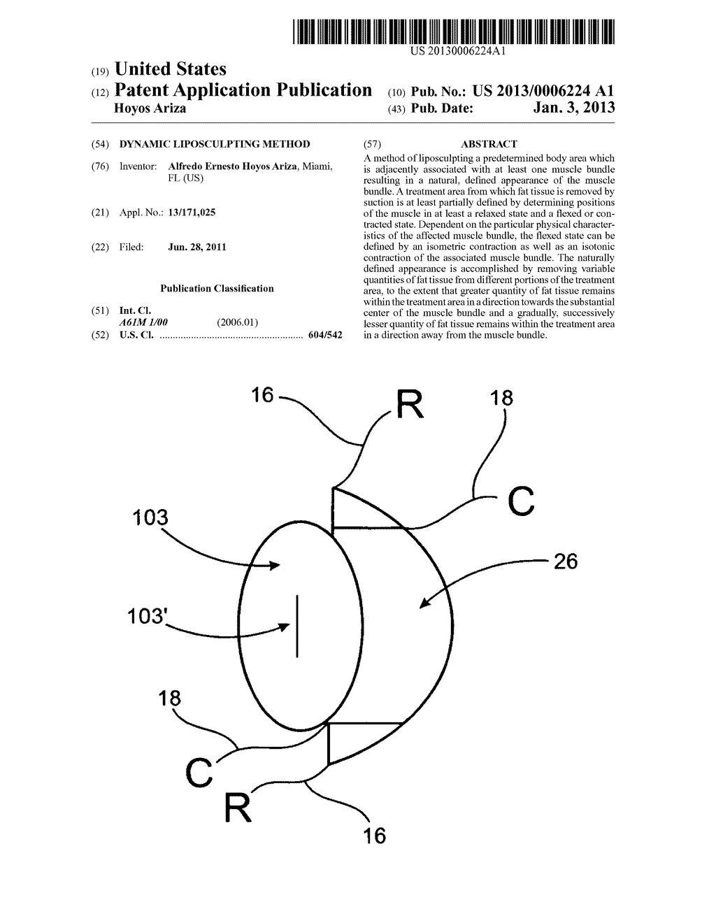 DYNAMIC LIPOSCULPTING METHOD - diagram, schematic, and image 01