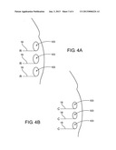 DYNAMIC LIPOSCULPTING METHOD diagram and image