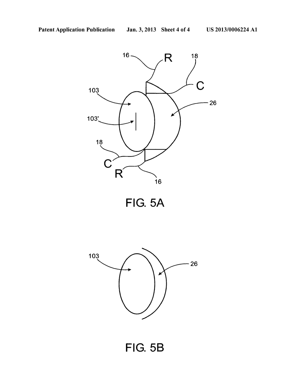 DYNAMIC LIPOSCULPTING METHOD - diagram, schematic, and image 05