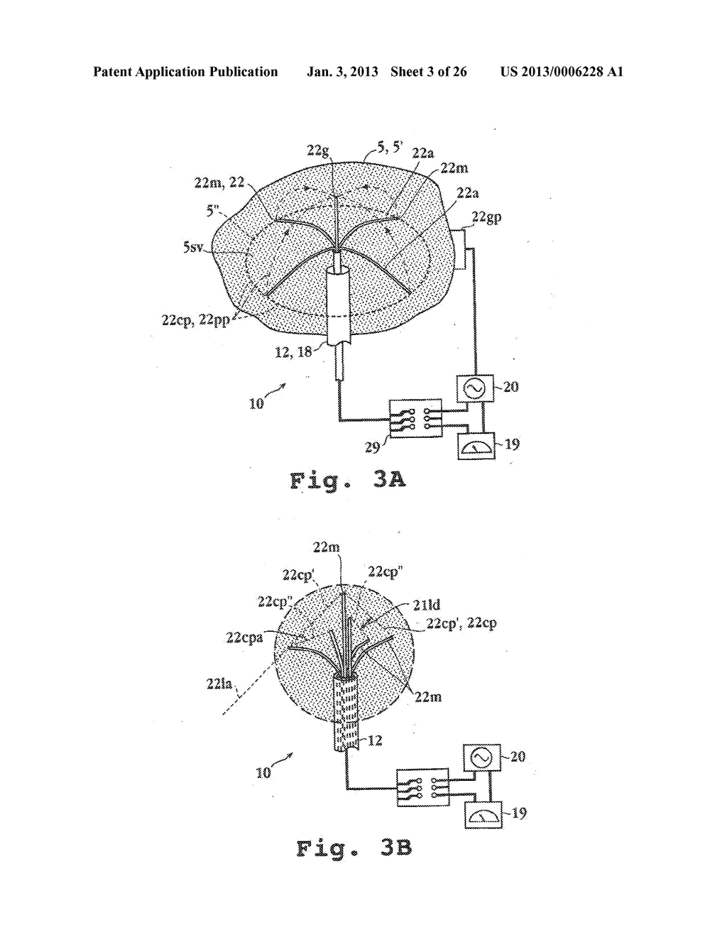 METHODS AND APPARATUSES FOR TISSUE TREATMENT - diagram, schematic, and image 04