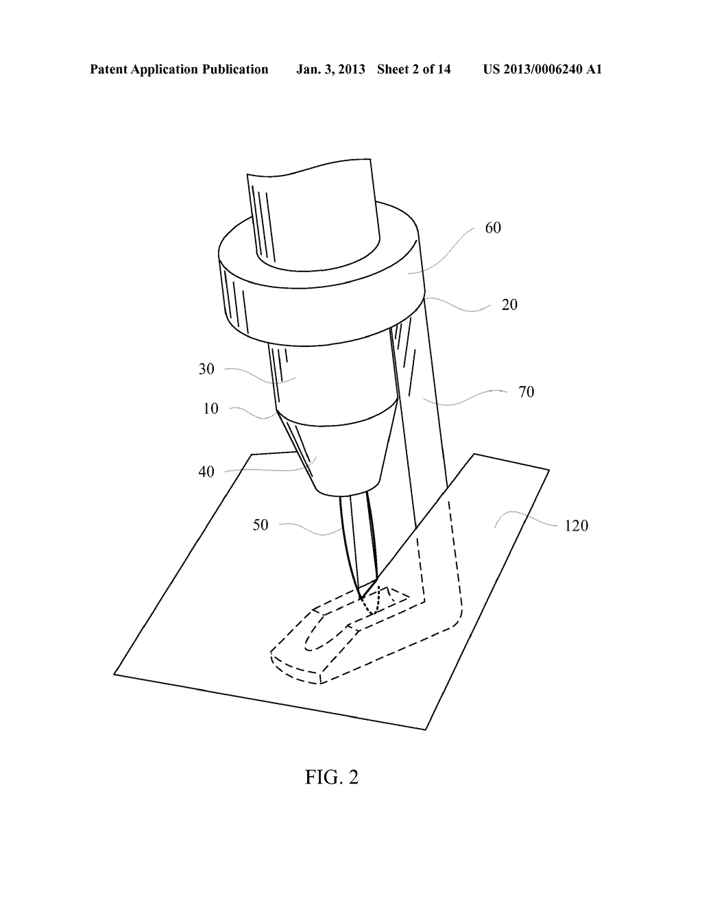 SURGICAL INSTRUMENT GUIDE - diagram, schematic, and image 03