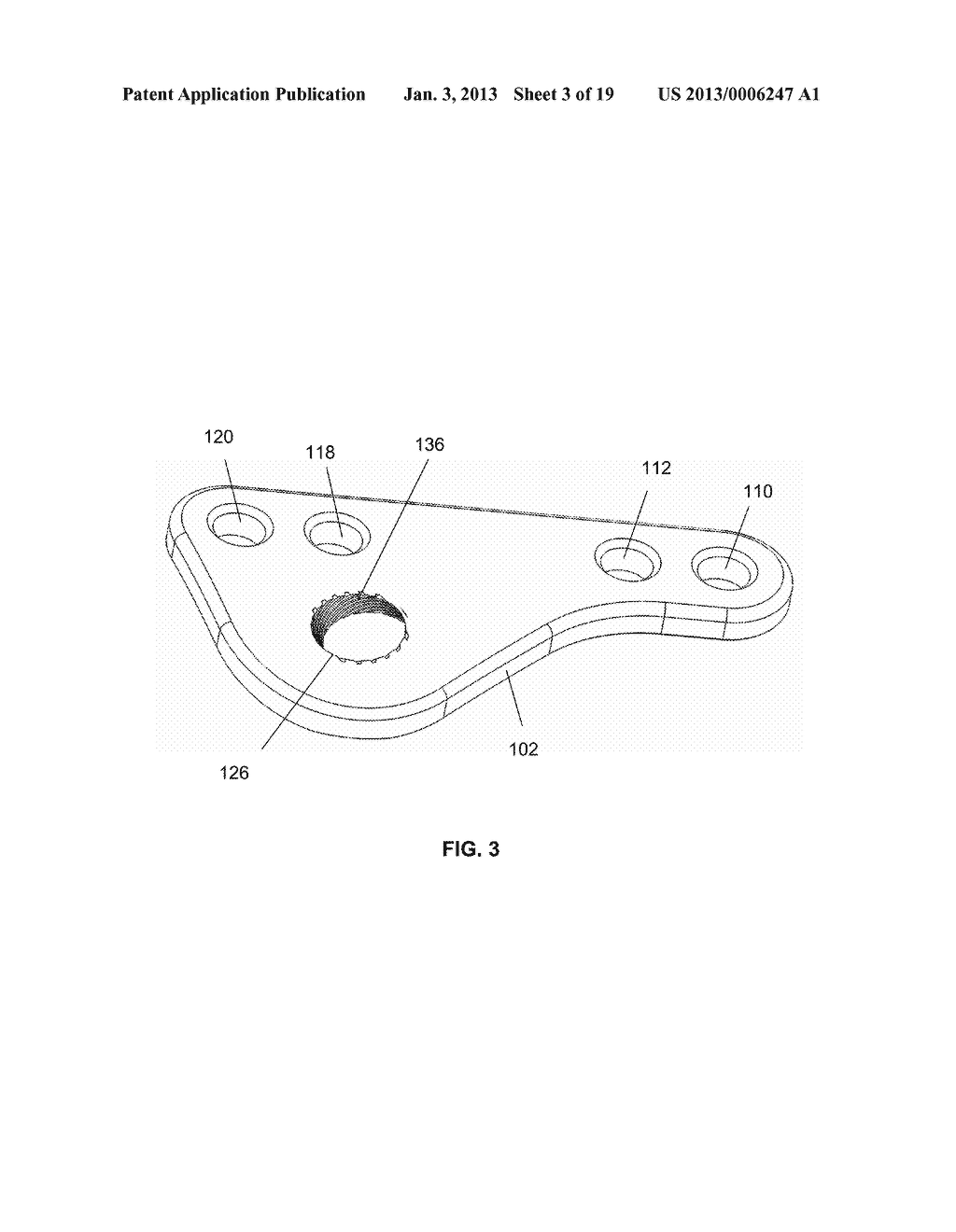 BONE PLATE HYBRID DEVICE - diagram, schematic, and image 04