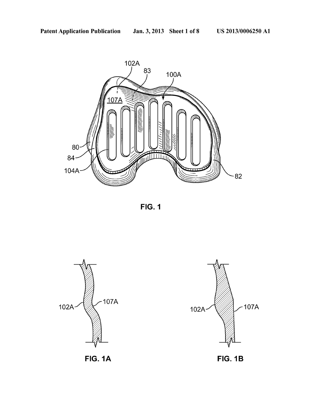 PATIENT-SPECIFIC BONE-CUTTING GUIDANCE INSTRUMENTS AND METHODS - diagram, schematic, and image 02