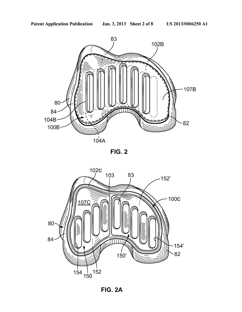 PATIENT-SPECIFIC BONE-CUTTING GUIDANCE INSTRUMENTS AND METHODS - diagram, schematic, and image 03