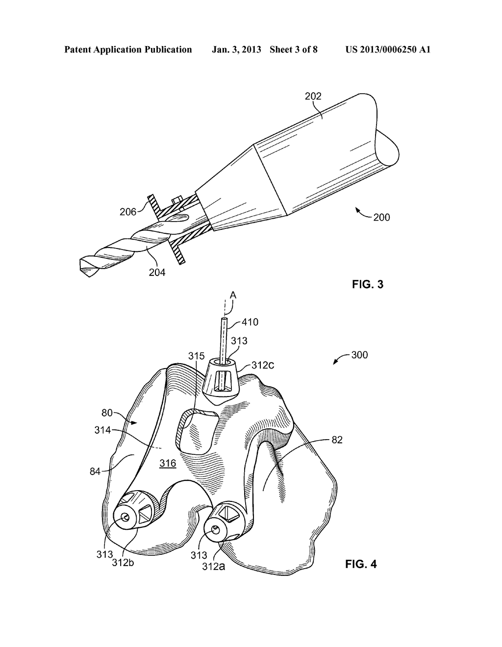 PATIENT-SPECIFIC BONE-CUTTING GUIDANCE INSTRUMENTS AND METHODS - diagram, schematic, and image 04