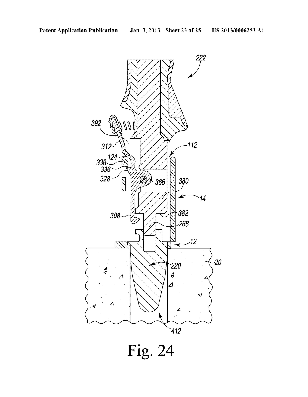 SURGICAL INSTRUMENT ASSEMBLIES FOR USE IN SURGICALLY PREPARING A TIBIA FOR     IMPLANTATION OF A PROSTHETIC COMPONENT - diagram, schematic, and image 24