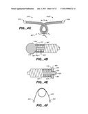 Sealing Clip, Delivery Systems, and Methods diagram and image