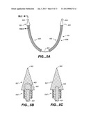 Sealing Clip, Delivery Systems, and Methods diagram and image