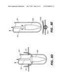 Sealing Clip, Delivery Systems, and Methods diagram and image