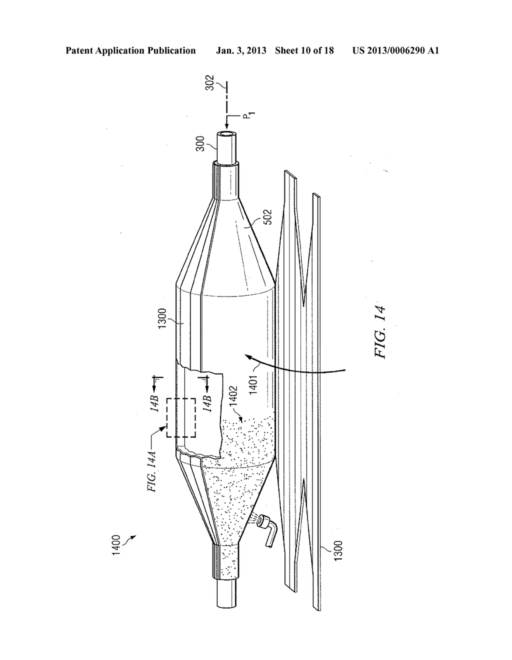 Non-Compliant Medical Balloon - diagram, schematic, and image 11