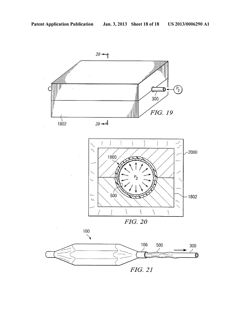 Non-Compliant Medical Balloon - diagram, schematic, and image 19