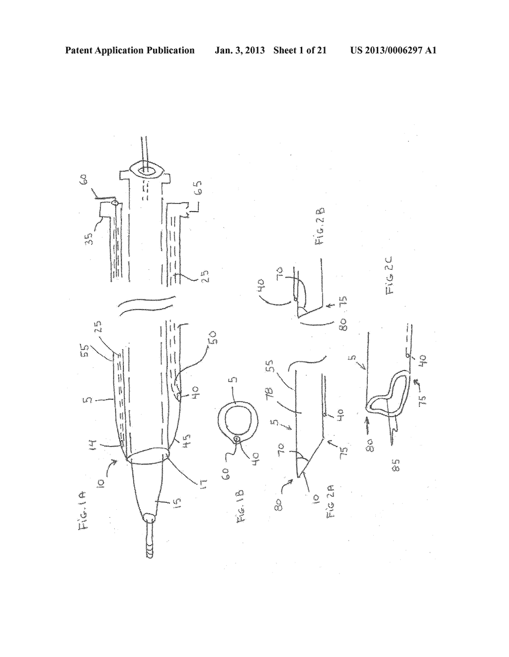 Large Vessel Closure Sheath - diagram, schematic, and image 02