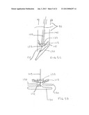 Large Vessel Closure Sheath diagram and image