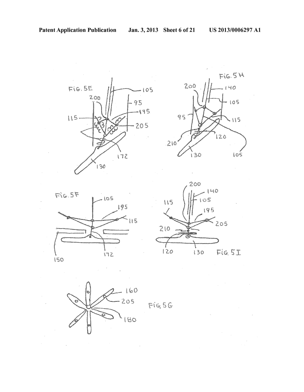 Large Vessel Closure Sheath - diagram, schematic, and image 07