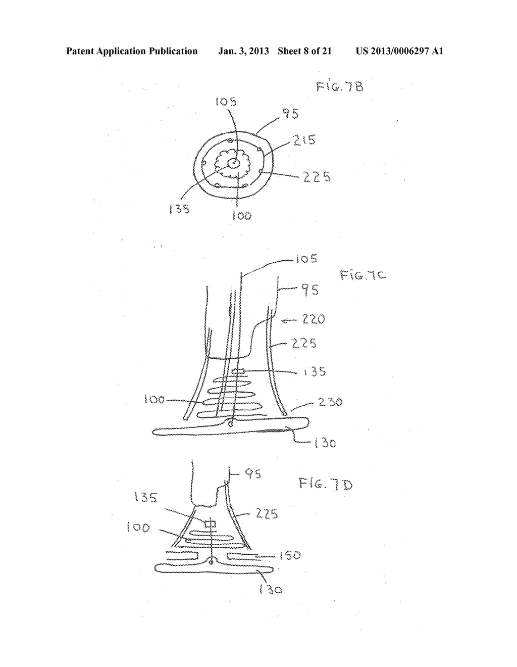 Large Vessel Closure Sheath - diagram, schematic, and image 09