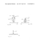 Large Vessel Closure Sheath diagram and image