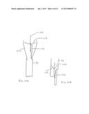 Large Vessel Closure Sheath diagram and image