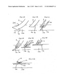 Large Vessel Closure Sheath diagram and image