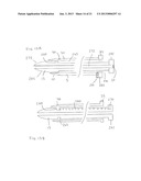 Large Vessel Closure Sheath diagram and image