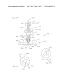 Large Vessel Closure Sheath diagram and image