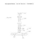 Large Vessel Closure Sheath diagram and image