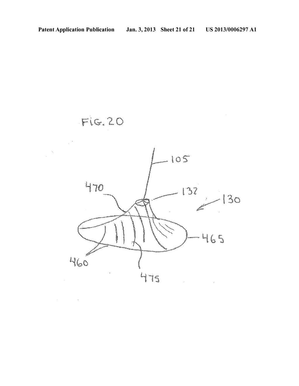 Large Vessel Closure Sheath - diagram, schematic, and image 22