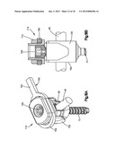 TRANSCONNECTOR diagram and image