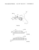 STIMULATION DEVICES AND METHODS diagram and image