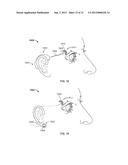 STIMULATION DEVICES AND METHODS diagram and image