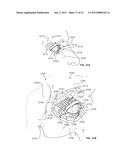 STIMULATION DEVICES AND METHODS diagram and image