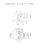 STIMULATION DEVICES AND METHODS diagram and image