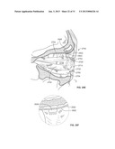 STIMULATION DEVICES AND METHODS diagram and image