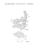 STIMULATION DEVICES AND METHODS diagram and image