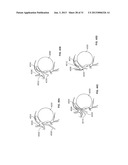 STIMULATION DEVICES AND METHODS diagram and image