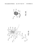 DEVICES, SYSTEMS, AND METHODS FOR INVERTING AND CLOSING THE LEFT ATRIAL     APPENDAGE diagram and image