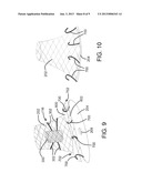 DEVICES, SYSTEMS, AND METHODS FOR INVERTING AND CLOSING THE LEFT ATRIAL     APPENDAGE diagram and image