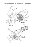 STENT POSITIONING SYSTEM AND METHOD diagram and image