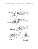 STENT POSITIONING SYSTEM AND METHOD diagram and image