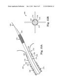 STENT POSITIONING SYSTEM AND METHOD diagram and image