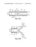 STENT POSITIONING SYSTEM AND METHOD diagram and image