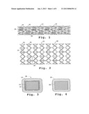 DRUG-DELIVERY ENDOVASCULAR STENT AND METHOD FOR TREATING RESTENOSIS diagram and image