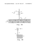 DRUG-DELIVERY ENDOVASCULAR STENT AND METHOD FOR TREATING RESTENOSIS diagram and image