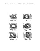 DRUG-DELIVERY ENDOVASCULAR STENT AND METHOD FOR TREATING RESTENOSIS diagram and image