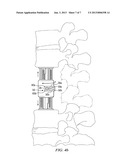 SPRING DEVICE FOR LOCKING AN EXPANDABLE SUPPORT DEVICE diagram and image