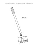 APPARATUS FOR ANTERIOR INTERVERTEBRAL SPINAL FIXATION AND FUSION diagram and image